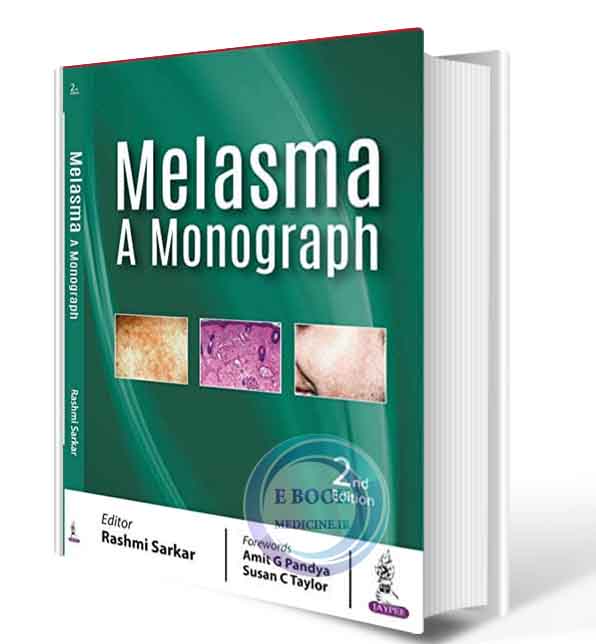 دانلود کتاب Melasma: A Monograph 2nd  2019 (ORIGINAL PDF)